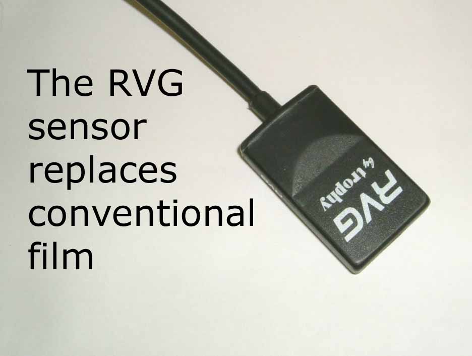 RVG Digital X Ray Sensor