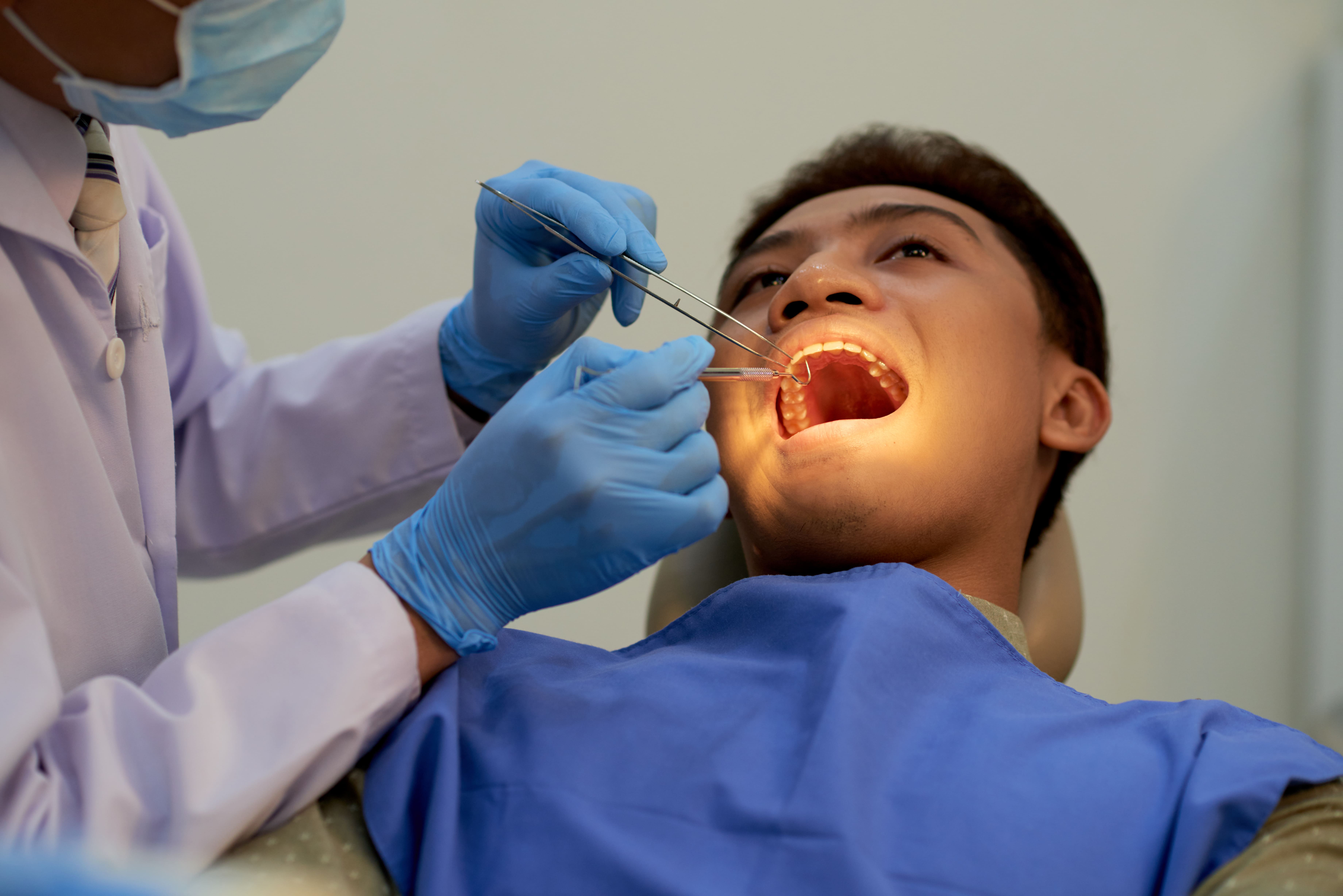 Dental Fillings